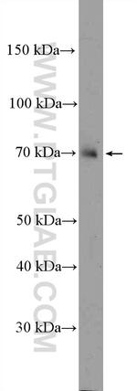 NCKIPSD Antibody in Western Blot (WB)