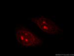 TIN2 Antibody in Immunocytochemistry (ICC/IF)