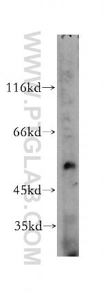 TIN2 Antibody in Western Blot (WB)