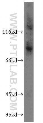 TLE3 Antibody in Western Blot (WB)
