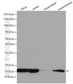 UBE2D1 Antibody in Western Blot (WB)