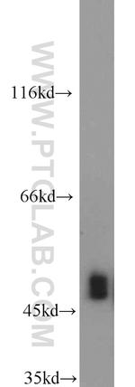 FH Antibody in Western Blot (WB)