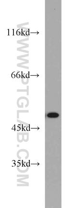 FH Antibody in Western Blot (WB)