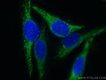 FH Antibody in Immunocytochemistry (ICC/IF)