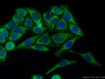 FH Antibody in Immunocytochemistry (ICC/IF)