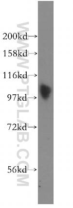 SP100 Antibody in Western Blot (WB)