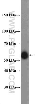 ARHGEF5 Antibody in Western Blot (WB)