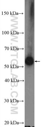 ARHGEF5 Antibody in Western Blot (WB)