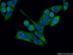 ARHGEF5 Antibody in Immunocytochemistry (ICC/IF)