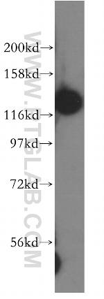 DDB1 Antibody in Western Blot (WB)