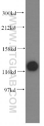 DDB1 Antibody in Western Blot (WB)