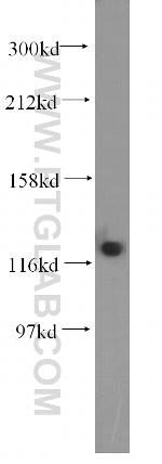 DDB1 Antibody in Western Blot (WB)