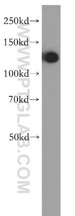 DDB1 Antibody in Western Blot (WB)