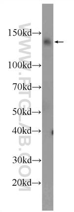 DDB1 Antibody in Western Blot (WB)