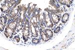 Cortactin Antibody in Immunohistochemistry (Paraffin) (IHC (P))