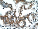 SPRY2 Antibody in Immunohistochemistry (Paraffin) (IHC (P))