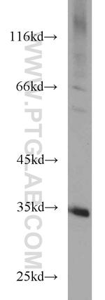 ECH1 Antibody in Western Blot (WB)