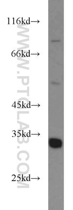 ECH1 Antibody in Western Blot (WB)