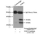 NT5C3 Antibody in Immunoprecipitation (IP)
