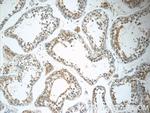 GKAP1 Antibody in Immunohistochemistry (Paraffin) (IHC (P))