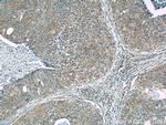 GKAP1 Antibody in Immunohistochemistry (Paraffin) (IHC (P))