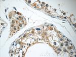 GKAP1 Antibody in Immunohistochemistry (Paraffin) (IHC (P))