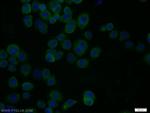 RPH3A Antibody in Immunocytochemistry (ICC/IF)