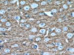 RPH3A Antibody in Immunohistochemistry (Paraffin) (IHC (P))