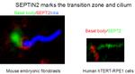 SEPT2 Antibody in Immunocytochemistry (ICC/IF)