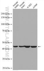 SEPT2 Antibody in Western Blot (WB)