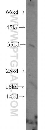 NMNAT1 Antibody in Western Blot (WB)