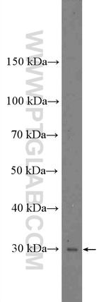 NMNAT1 Antibody in Western Blot (WB)