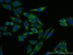 EEF1A1 Antibody in Immunocytochemistry (ICC/IF)