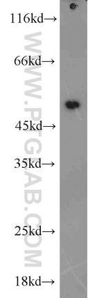 EEF1A1 Antibody in Western Blot (WB)