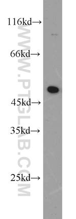 EEF1A1 Antibody in Western Blot (WB)