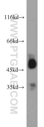 EEF1A1 Antibody in Western Blot (WB)