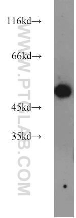 EEF1A1 Antibody in Western Blot (WB)