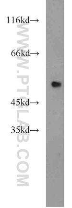 EEF1A1 Antibody in Western Blot (WB)