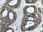 MELK Antibody in Immunohistochemistry (Paraffin) (IHC (P))