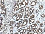 MELK Antibody in Immunohistochemistry (Paraffin) (IHC (P))