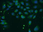 TACC2 Antibody in Immunocytochemistry (ICC/IF)