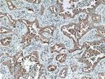 TACC2 Antibody in Immunohistochemistry (Paraffin) (IHC (P))