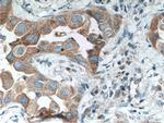 TACC2 Antibody in Immunohistochemistry (Paraffin) (IHC (P))