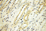 XPO6 Antibody in Immunohistochemistry (Paraffin) (IHC (P))