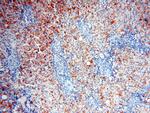 XPO6 Antibody in Immunohistochemistry (Paraffin) (IHC (P))