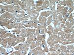 XPO6 Antibody in Immunohistochemistry (Paraffin) (IHC (P))