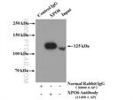 XPO6 Antibody in Immunoprecipitation (IP)