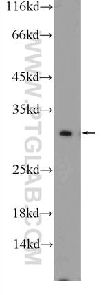 COX7C Antibody in Western Blot (WB)