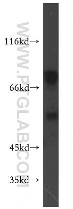 PSMD12 Antibody in Western Blot (WB)