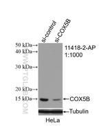 COX5B Antibody in Western Blot (WB)